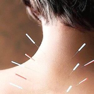 Experto/a MTC en acupuntura